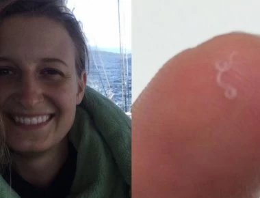 Κοιτάχτηκε στον καθρέφτη και είδε ένα σκουλήκι να κουνιέται μέσα στο μάτι της! (βίντεο)